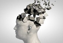 انواع از دست دادن حافظه